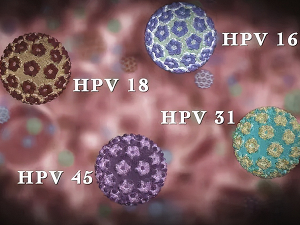 hpv分型检测报告结果值怎么看？求正常参考范围图片_1