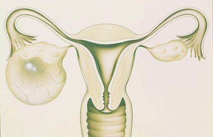 卵巢囊肿3cm,性激素六项正常,会影响怀孕吗-