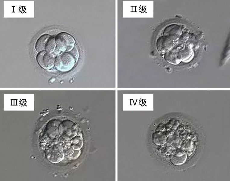 移植哪种胚胎可以提高试管婴儿的成功率？