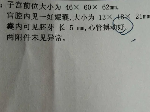 b超单上的原始心管搏动就是胎心的意思吗？是不是一回事？