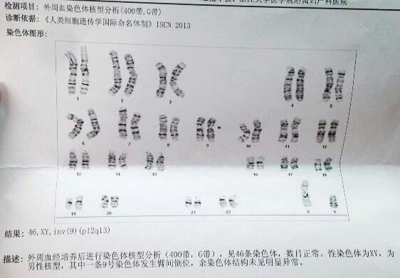 九号染色体臂间倒位