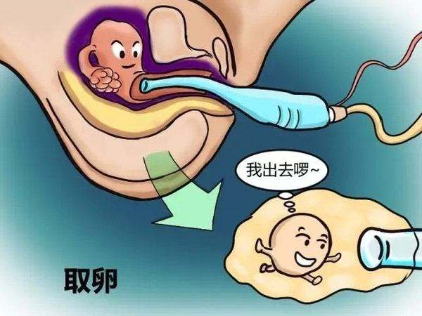 取卵手术具体操作