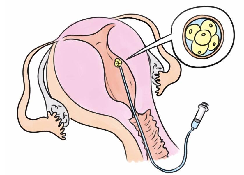 大医优孕健康咨询