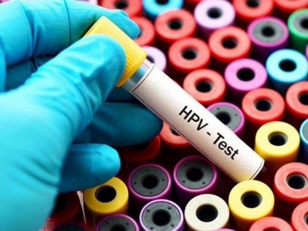 单纯的高危型hpv45阳性算不算严重？能自愈吗？