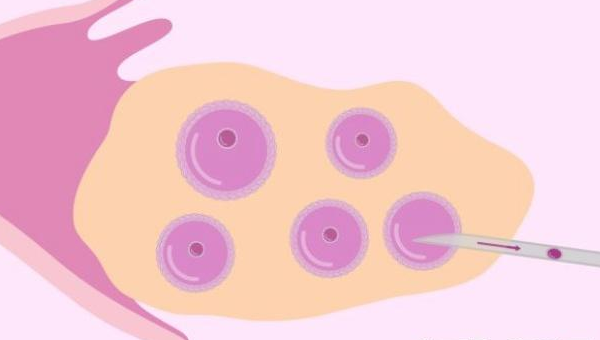 第一次促排取20个卵泡全是空的怎么回事？
