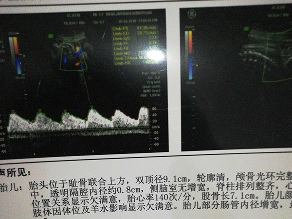 39周出现哪10种征兆提醒宝宝已经入盆且就要出生了？