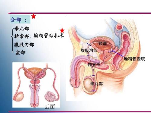 结扎