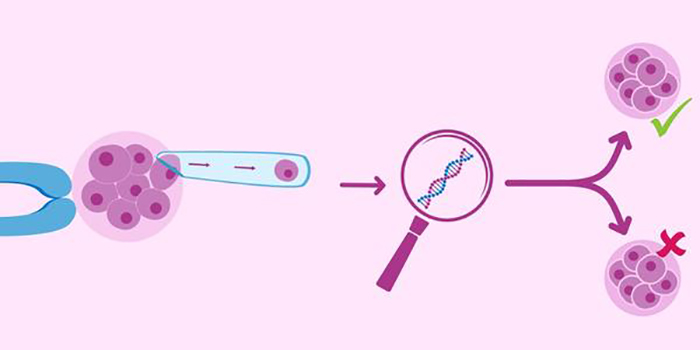 做试管要检查胚胎染色体吗