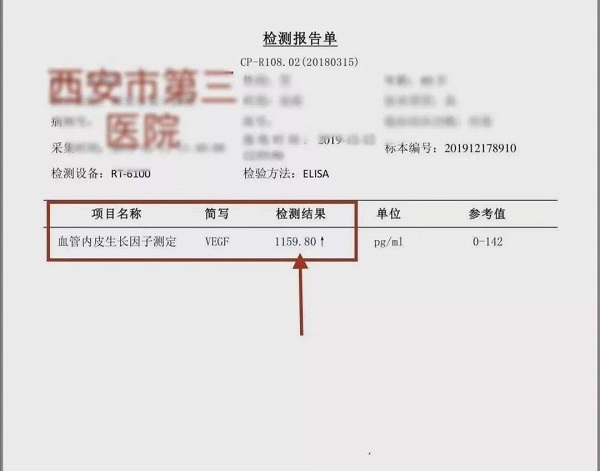 POMES综合症检查单