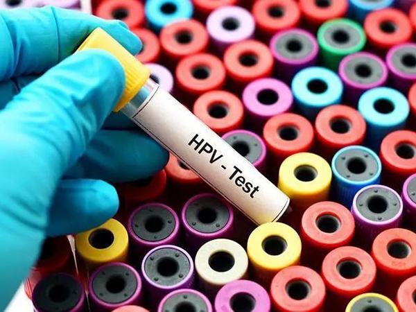 为啥过来人都不建议20岁以下的年轻人检查hpv？