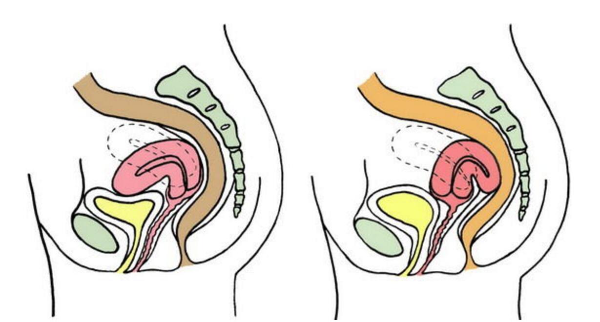 子宫后位是什么意思.jpg
