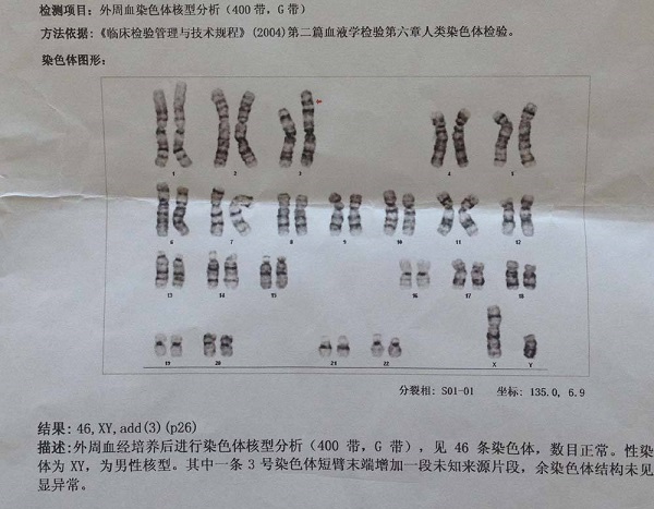 染色体46x可以在武汉医院做试管吗？