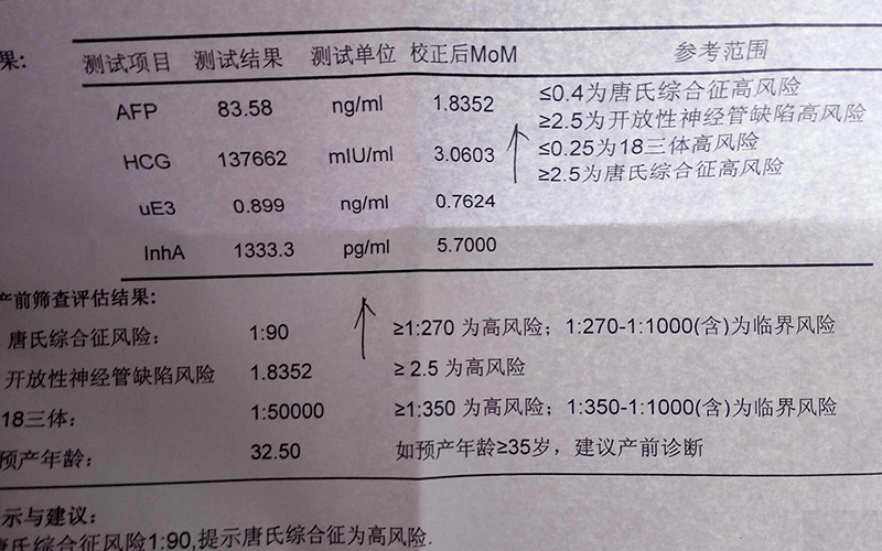 dna三体21、18、13三个数据看男女公式是什么样的？