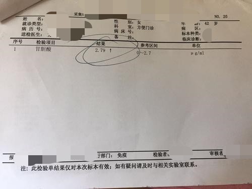 甘胆酸检查报告