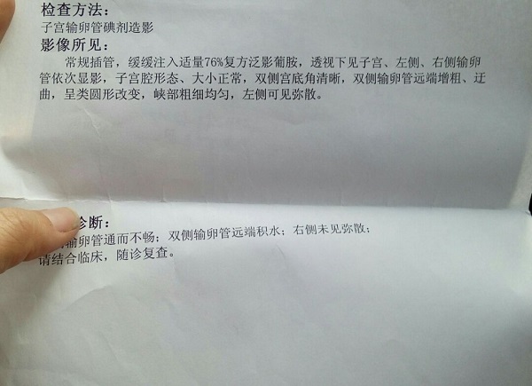 输卵管堵塞检查单