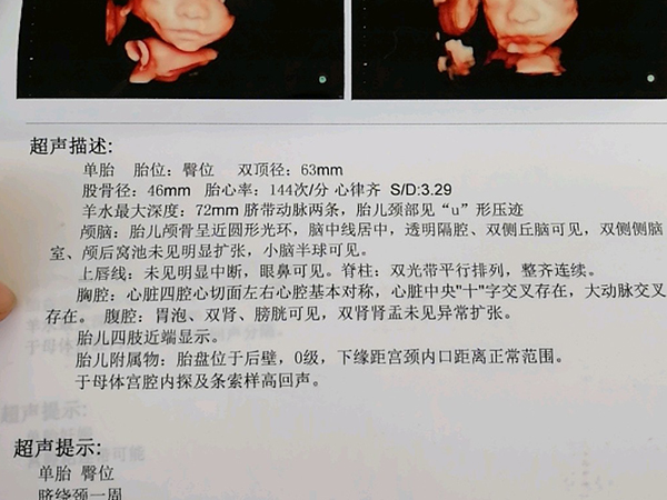 26周四维打印单子看男女准确率有多高？能达到100%吗？