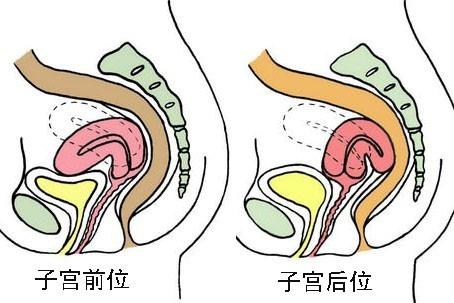 子宫前位生男孩比率大