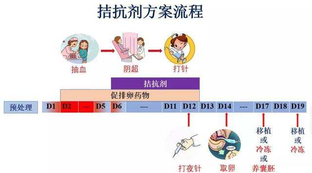 试管婴儿选择拮抗剂方案促排一共要多少天？