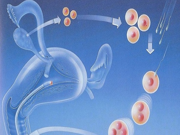 疤痕子宫移植后宫腔有2厘米积液会着床失败吗-