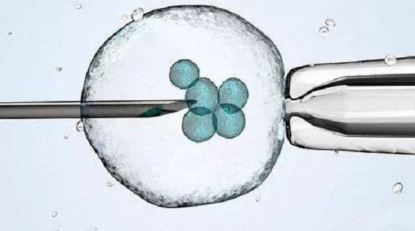 试管婴儿治疗方案确定