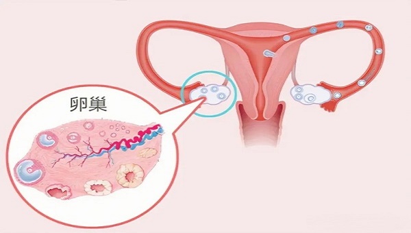 卵巢amh值低至0.7还能做试管婴儿要孩子吗？