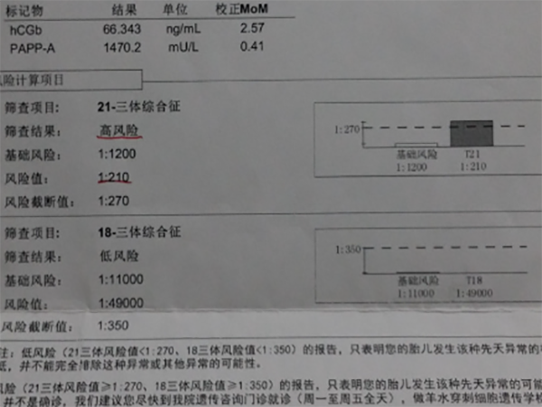 患有轻微唐氏综合症的孩子正常智商能达到多少？