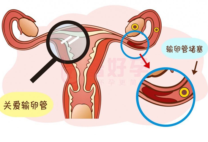 上海长征医院试管婴儿