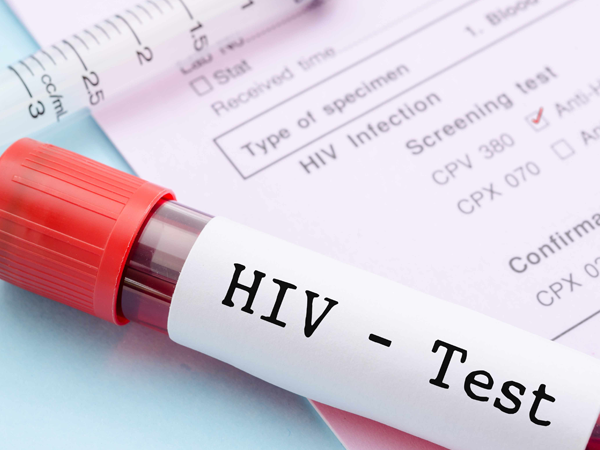 怀孕11周到医院建档查hiv的结果会打电话通知吗？