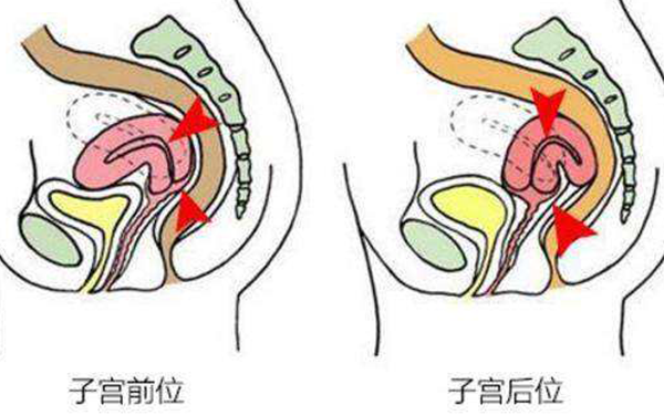 怀孕3个月，b超显示子宫后位，对宝宝好吗？