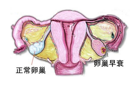 做试管婴儿对人体有哪些危害？